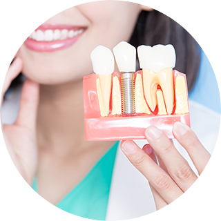 隣接する歯への影響が少ない